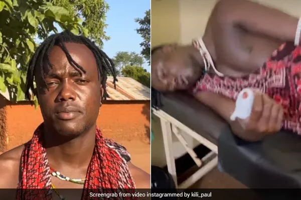 Kili Paul, internet sensation, attacked with knife