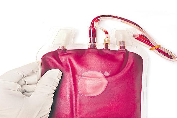 Long Covid sufferers in Europe seeking experimental 'blood washing' in Germany