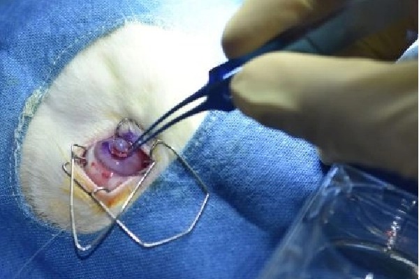 First 3-D printed human cornea developed in Hyderabad