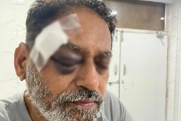 Pushed by cops, Maha Congress' Dr. Nitin Raut hurt in Bharat Jodo Yatra