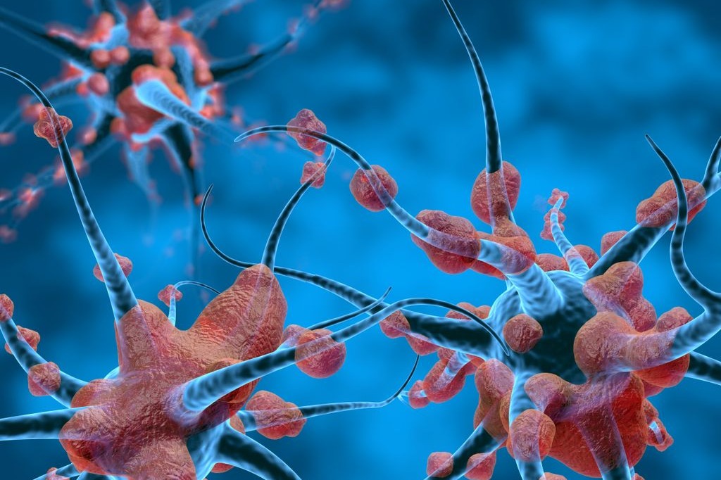 Indian scientists develop AI tool for nerve disorders in hand, forearm