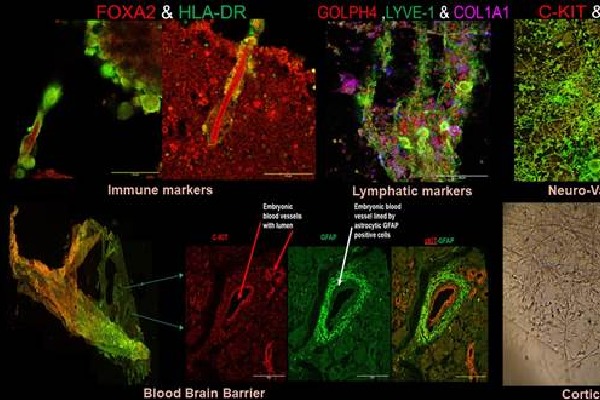 Indian researchers develop 'organoid' to help in neurodegenerative diseases