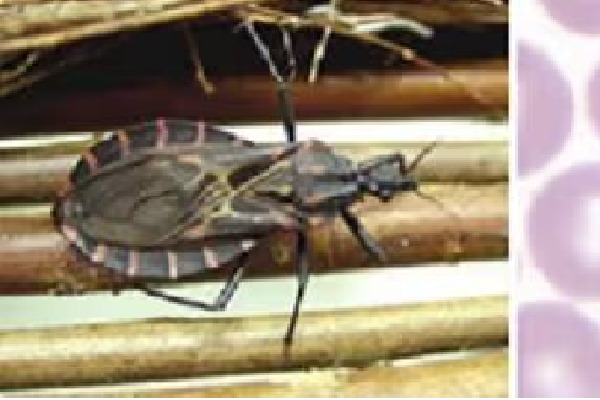 World Chagas Disease Day: WHO calls for early detection for better health