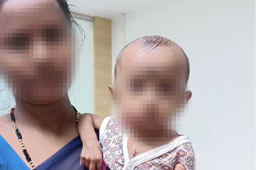 ఏడు నెల‌ల బాబుకు గుండెలో రంధ్రం: క‌ర్నూలునే తొలిసారిగా ఇంత చిన్న‌వ‌య‌సులో  ఓపెన్ హార్ట్ సర్జరీ