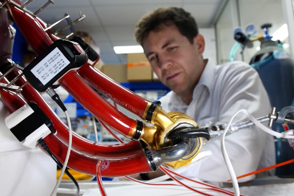 Australian man becomes world-1st to live with durable artificial heart for over 100 days