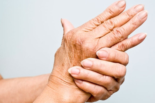 Study finds common blood fat linked to rheumatoid arthritis in women