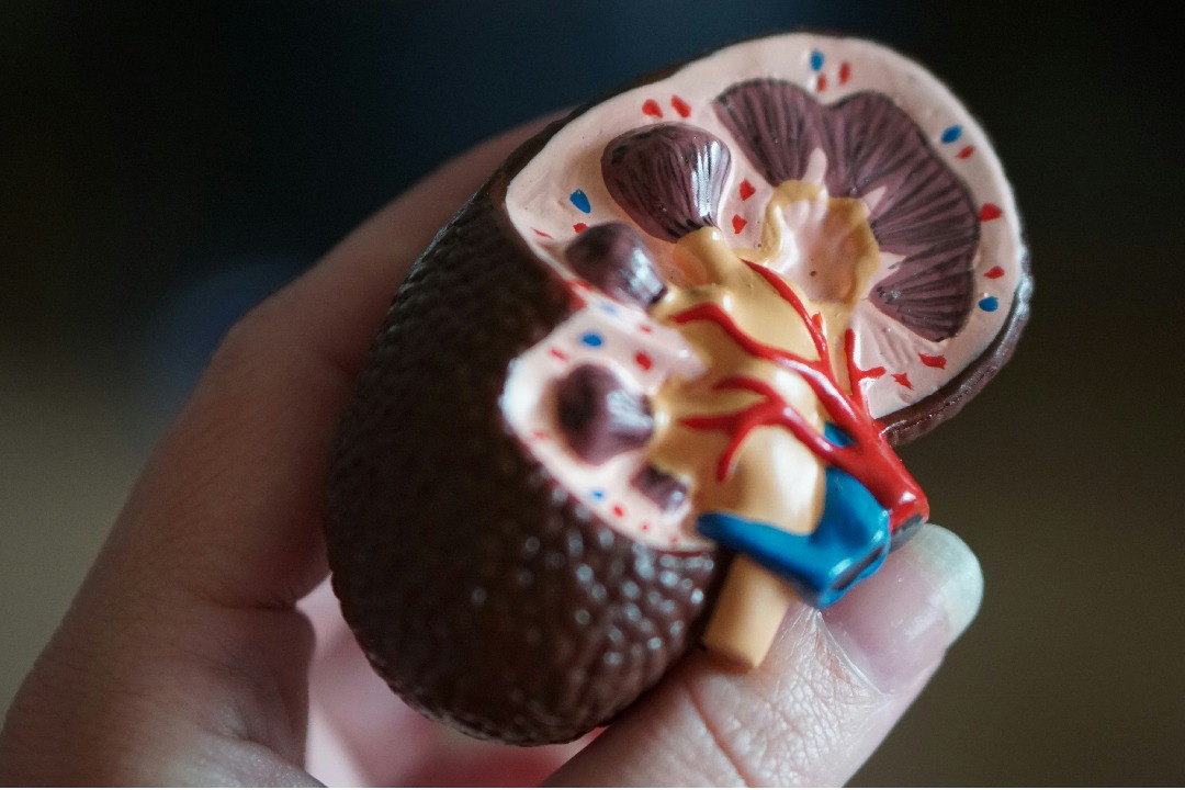 Best Foods to Prevent Kidney Stones, What to Avoid