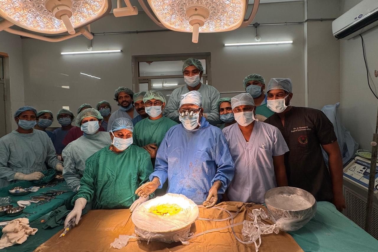 Telangana’s first intestine transplant performed at Osmania Hospital