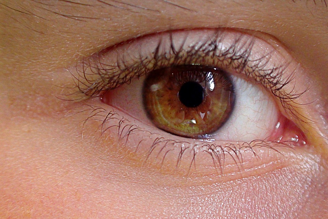 Summer’s Silent Threat: How to Protect Yourself from Pink Eye!