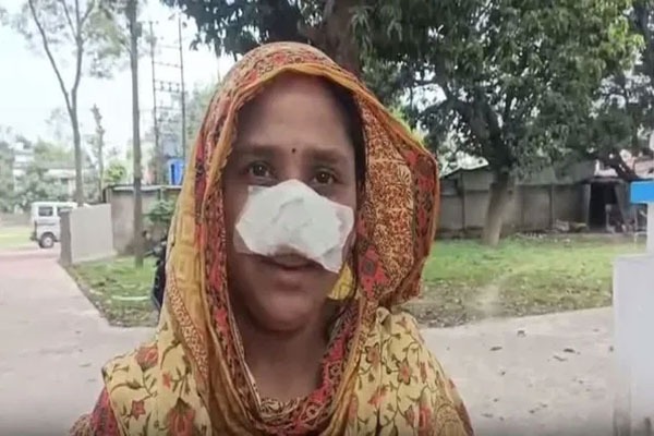 West Bengal Husband Bites Wifes Nose