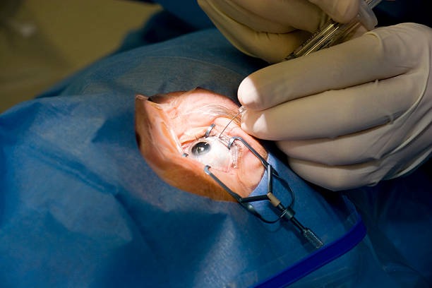 Spinal Tumor Removed Through Eye Socket A Medical Miracle