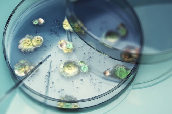 Is Aspergillus the Next Pandemic