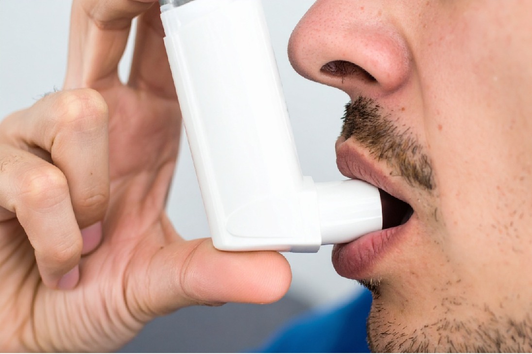 Inflammatory cells continue in blood after treatment of severe asthma: Study