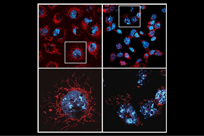 Study decodes why promising cancer treatments trigger serious side effects