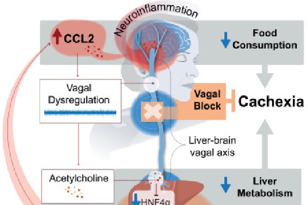 Study identifies reasons behind deadly weight loss in cancer patients