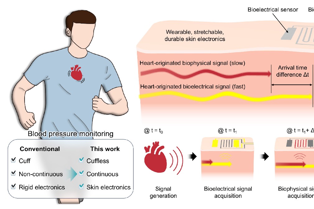 New bandage-like wearable monitor to enable continuous measurement of BP