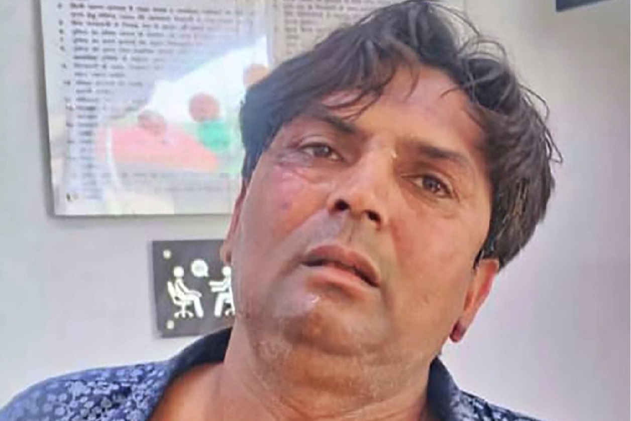Delhi CM attack case deepens; police arrest Rajesh’s associate Tahseen in alleged murder plot