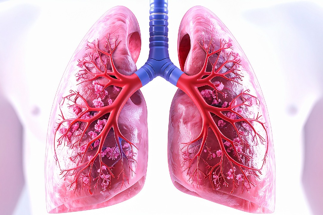 Antibody drug shows promise against lung cancer in first human trial