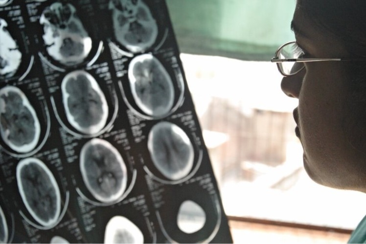 More than 1 in 3 people worldwide live with brain disorders, 11 million die annually: Report