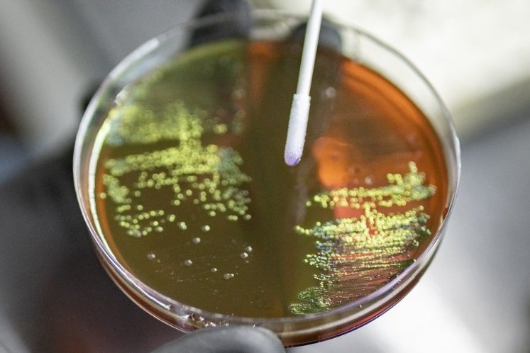 Early action on AMR key to ensure infections remain treatable, surgeries stay safe: WHO