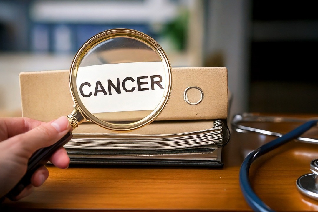 Study links common childhood virus to bladder cancer