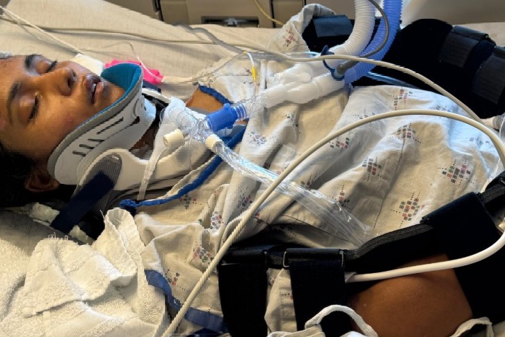 US: Indian girl in coma after crash; community mobilises to help