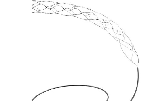 AIIMS-led trial on most advanced brain stent shows promise for stroke patients