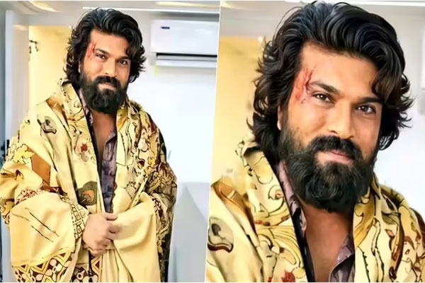రామ్‌చరణ్‌కి అంత పెద్ద గాయమైందా.. వైరల్ అవుతున్న ఫొటో!