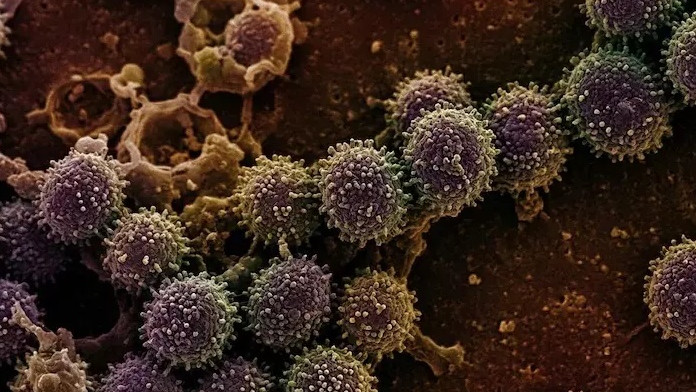 WHO Clarifies Hanta Virus Not Like COVID19 or Flu
