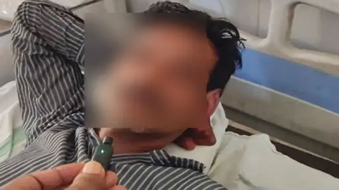 Madya Pradesh Farmer Mutilates Himself With Axe To Become An Ascetic