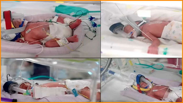 Australian couple blessed with quadruplet girls face new logistical challenges