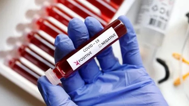 COVID 19 alert in Hyderabad as patients flock to hospitals with symptoms