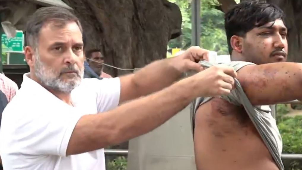 Rahul Gandhi slams government over pellet gun injuries to students