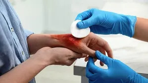 Wounds vanish without stitches IICT new innovation