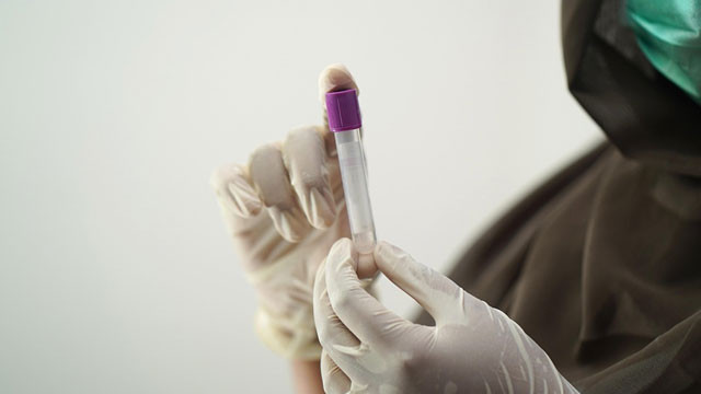 Parliamentary Panel suggests mandatory kidney tests for those over 20 to Center