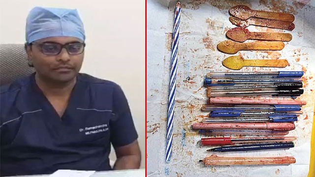 Palnadu woman goes for chest pain doctors find 14 pens and 5 spoons in her stomach