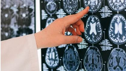 Do we use only 10 percent of our brain how much truth is in this long standing claim
