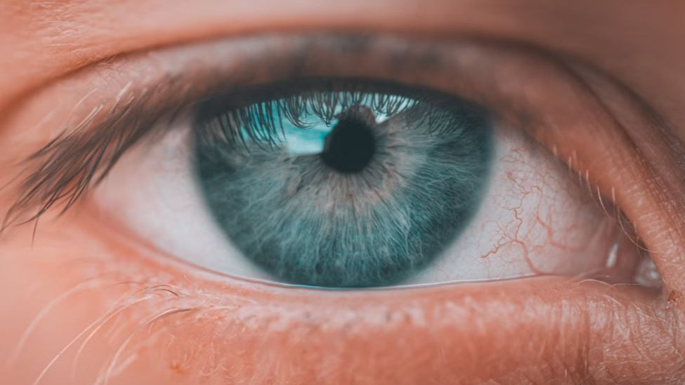 Are these eye changes signs of a heart attack