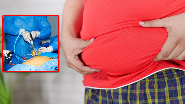 Bariatric surgery in Indian youth under 35 what doctors say