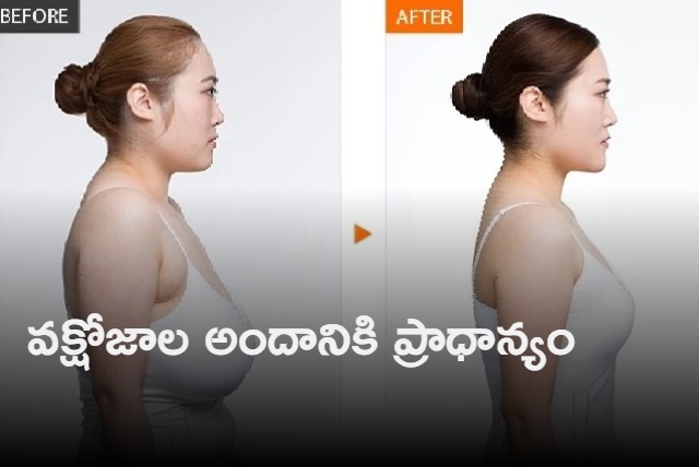 15000 women underwent breast reduction operations in India