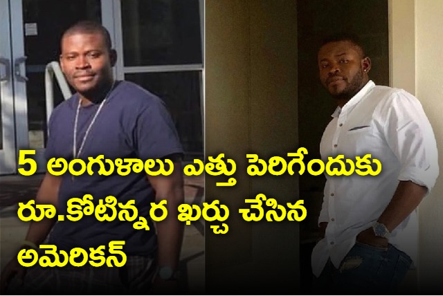 US Man Spends Rs1 and half Crore On Painful Surgeries To Grow 5 Inches Taller