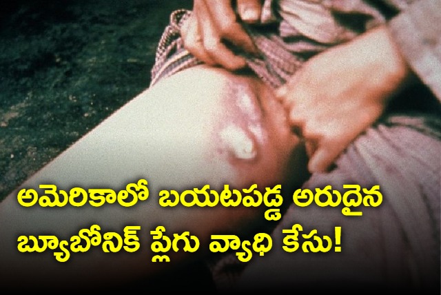 Rare Case Of Bubonic Plague In US It Killed 50 Million In 14th Century