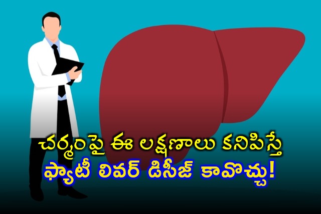 If these symptoms appear on the skin it could be fatty liver disease