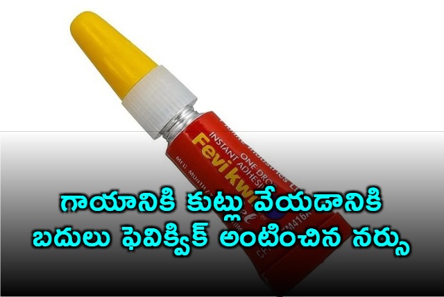 Nurse Uses Fevikwik Instead Of Suturing Wound In Karnataka