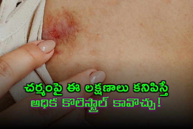 high cholesterol signs that show on skin