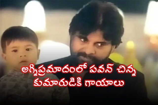 Deputy CM Pawan Kalyans Son Injured in Singapore Fire Accident