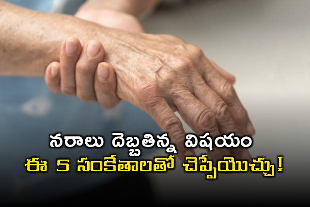 Nerve Weakness 5 Signs You Should Know