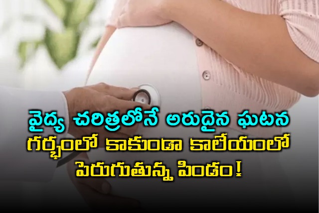 Rare Liver Pregnancy Case Reported in Meerut Uttar Pradesh