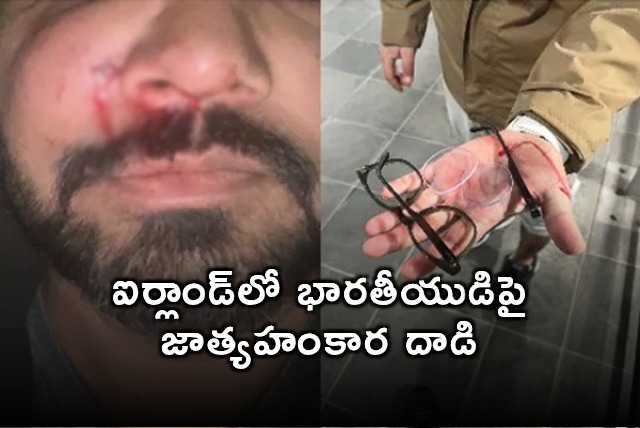 Indian Origin Mans Face Fractured In Unprovoked Racist Attack In Ireland
