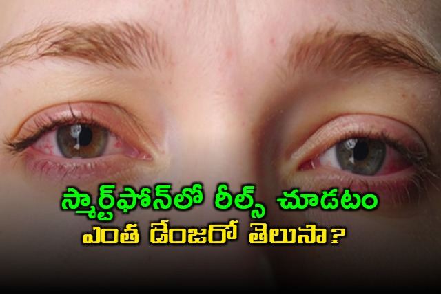 Just 1 hour of social media reels on smartphones can cause eye fatigue says Study